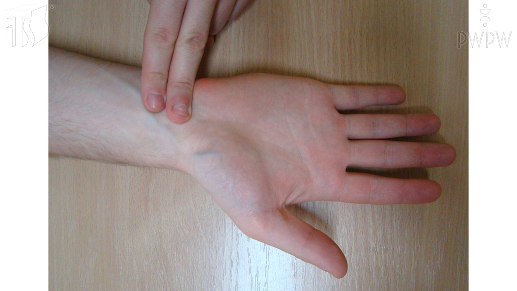 Wie sollen Sie Erste Hilfe einem Unfallopfer leisten, dessen Puls fühlbar ist, das aber nicht atmet?